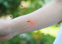 Pourquoi les moustiques piquent-ils certaines personnes davantage<div class="yasr-vv-stars-title-container"><div class='yasr-stars-title yasr-rater-stars'
id='yasr-visitor-votes-readonly-rater-a4b3546d7da2d'
data-rating='0'
data-rater-starsize='16'
data-rater-postid='4155'
data-rater-readonly='true'
data-readonly-attribute='true'
></div><span class='yasr-stars-title-average'>0 (0)</span></div> Pourquoi les moustiques piquent-ils certaines personnes davantage<div class="yasr-vv-stars-title-container"><div class='yasr-stars-title yasr-rater-stars'
id='yasr-visitor-votes-readonly-rater-bd6a2de43ad58'
data-rating='0'
data-rater-starsize='16'
data-rater-postid='4155'
data-rater-readonly='true'
data-readonly-attribute='true'
></div><span class='yasr-stars-title-average'>0 (0)</span></div>
